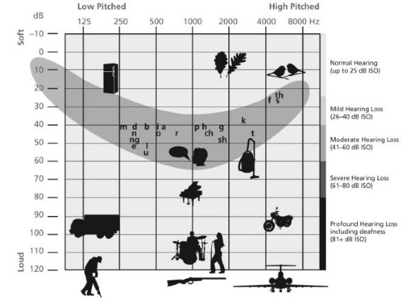 Hearing Loss Often Impacts Specific Sounds